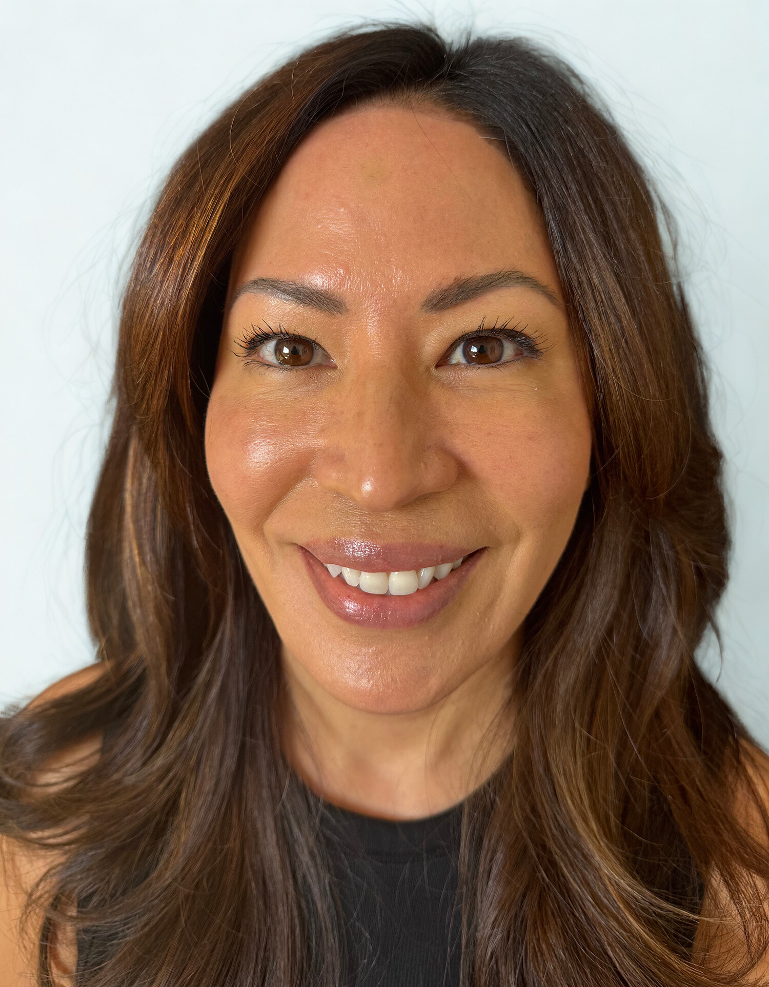 After Image: Facial Balancing - front
