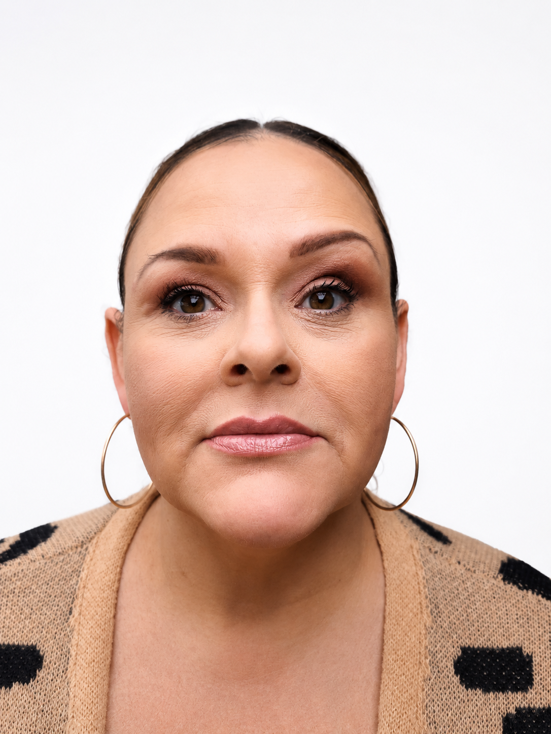 After Image: Facial Balancing - front